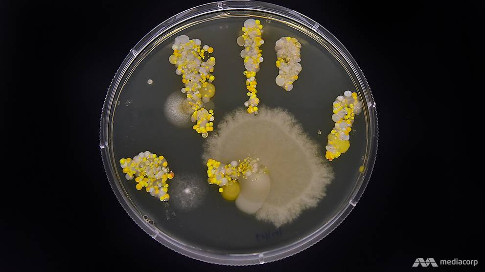 In pictures: The bacteria living on your hands right now - CNA