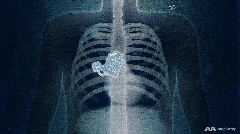 What To Do When You Ve Swallowed Something You Shouldn T Have Cna What To Do When You Ve Swallowed Something You Shouldn T Have Cna