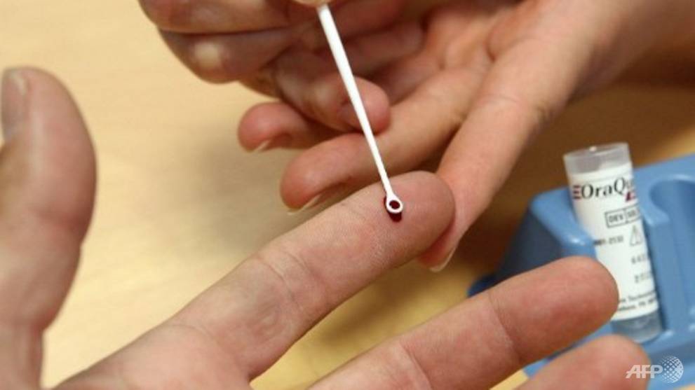 NUH cures patient of Hepatitis B by stopping medication in new trial CNA